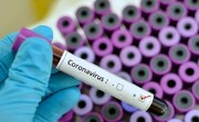 تولید کیت تشخیص سریع ویروس کرونا، بزودی در کشور