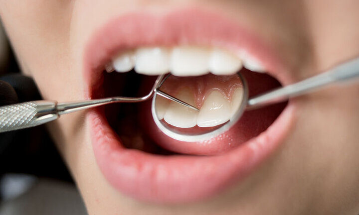 ابلاغ تعرفه‌های جدید دندانپزشکی سال ۹۹