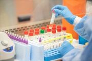 تعرفه آزمایش PCR و قیمت کیت تشخیصی کرونا اعلام شد