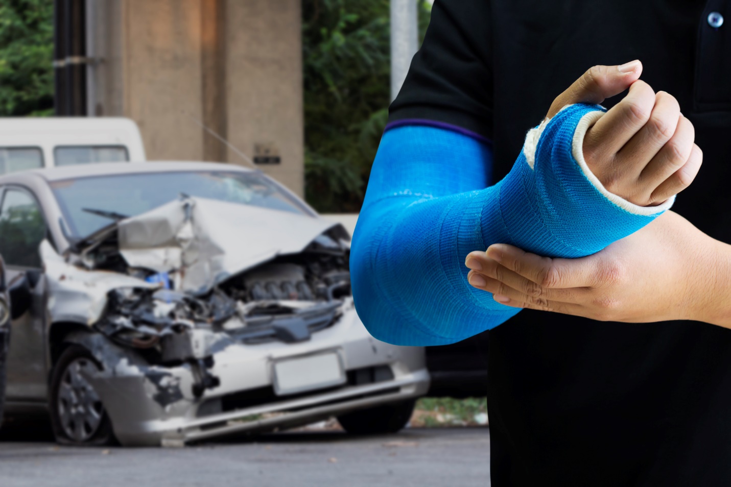 خرید بیمه بدنه و شخص ثالث:راهکار جبران خسارات سنگین رانندگی (پاییز ۱۴۰۰)