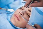 اعلام فهرست کشورهایی که بیشترین عمل جراحی پلاستیک را دارند| ایران رتبه اول در عمل جراحی بینی