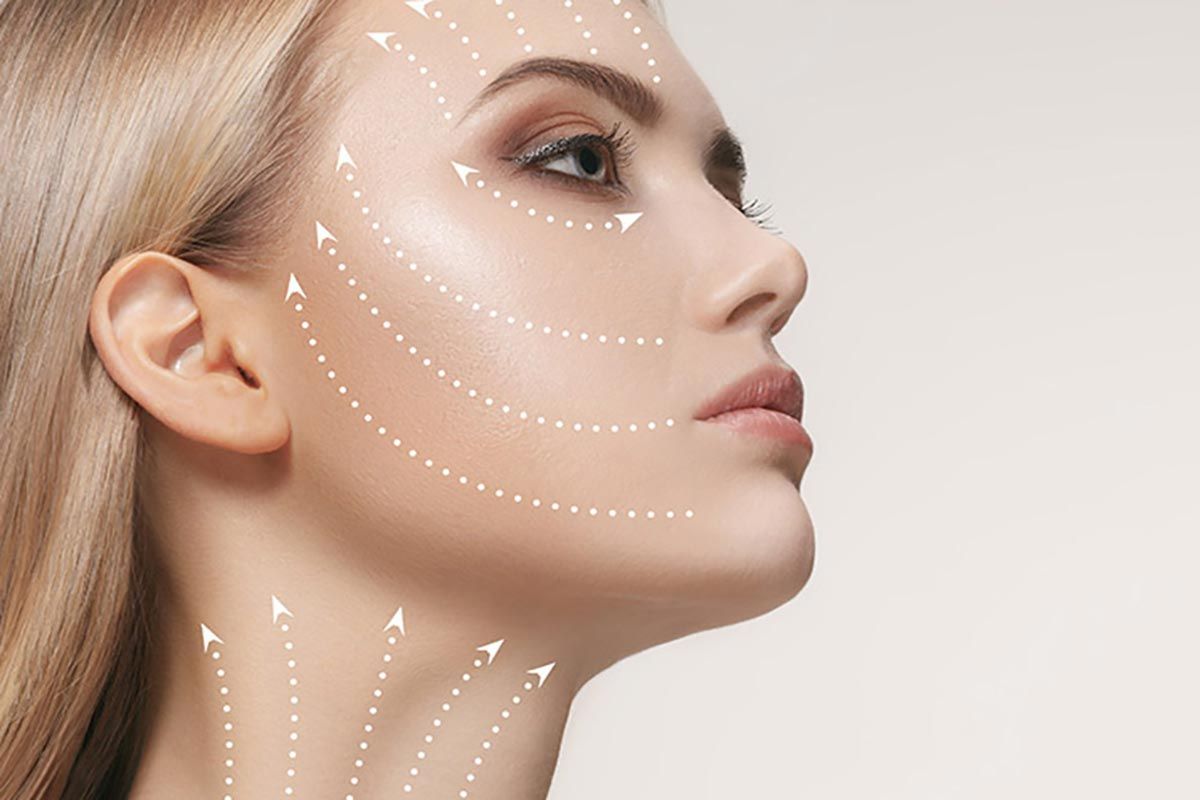 لیفت گردن با دکتر شیرزادگان