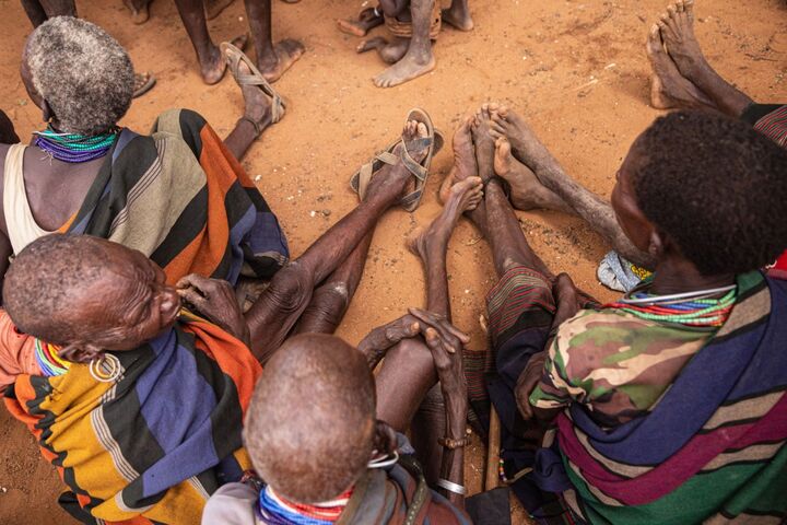 گرسنگی قاتل کودکان در اوگاندا