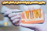 بهترین متخصص ایمپلنت دندان در شمال تهران
