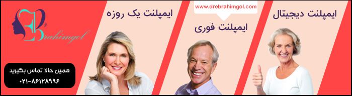 ایمپلنت فوری دندان