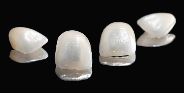 انواع روکش دندان و مقایسه آنها با دیگر روش‌های درمانی