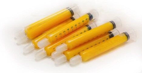 هزینه تزریق چربی در نواحی مختلف بدن هزینه تزریق چربی در نواحی مختلف بدن