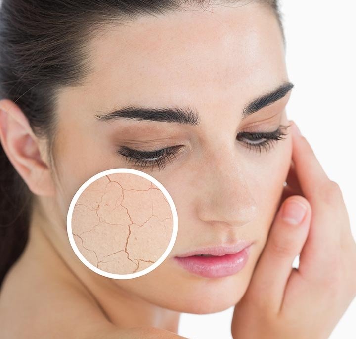 نکات مراقبت از پوست صورت