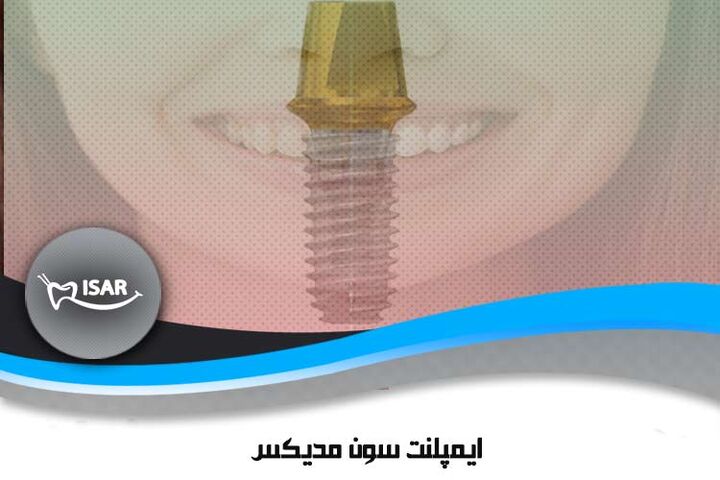 معرفی ایمپلنت کره ای سون مدیکس sewon medix معرفی ایمپلنت کره ای سون مدیکس sewon medix
