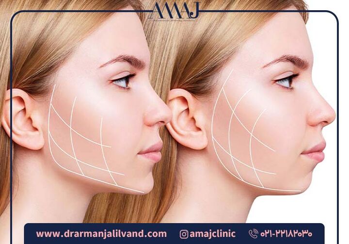 همه چیز در مورد کانتورینگ صورت همه چیز در مورد کانتورینگ صورت