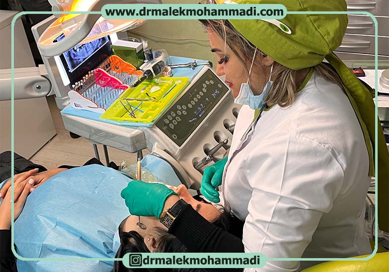 مراقبت های بعد از لمینیت دندان