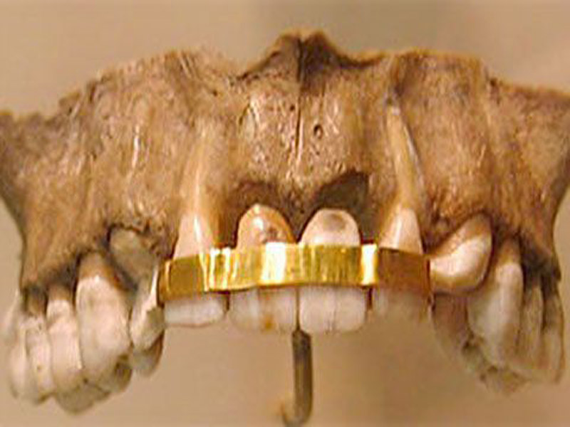 حقایق شگفت انگیز درباره ارتودنسی دندان