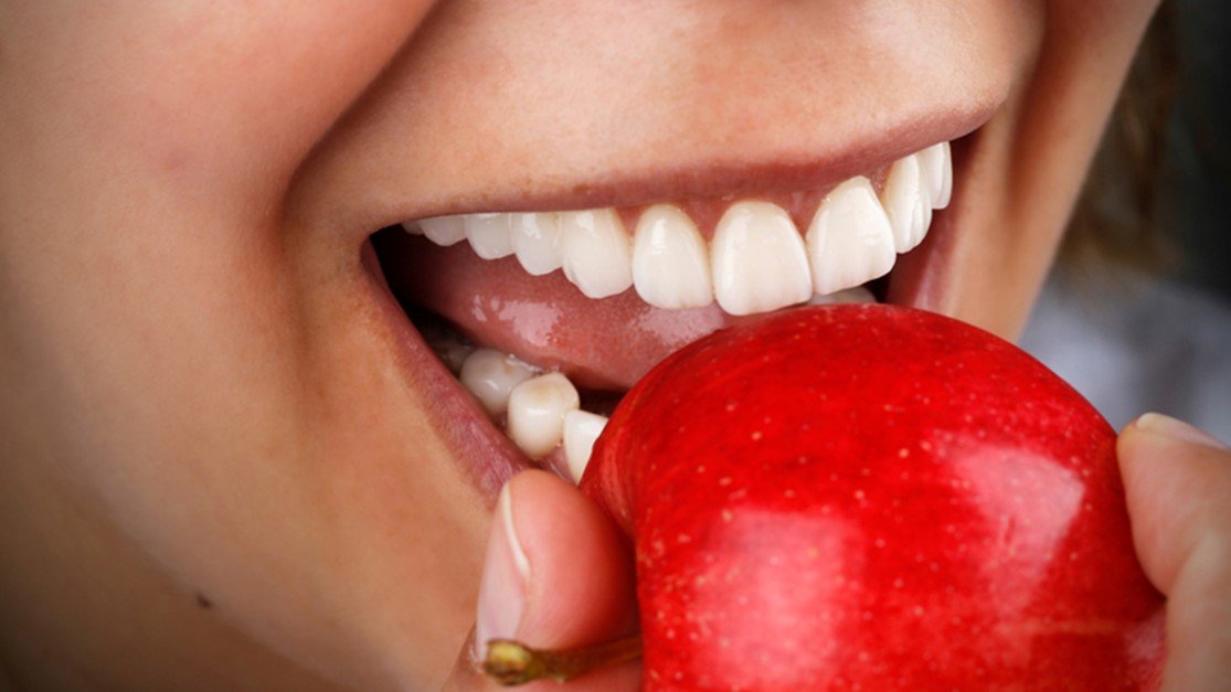 با لمینت دندان دیگر نگران لبخند زدن نباشید