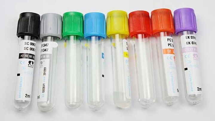 تولید بومی «لوله خلاء خونگیری» با فناوری فراصوت تولید بومی «لوله خلاء خونگیری» با فناوری فراصوت