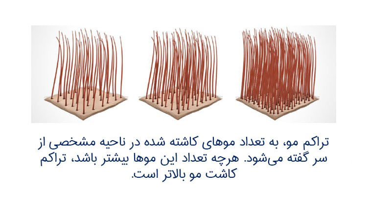 بیشترین تراکم کاشت مو چقدر است؟ (عوامل تأثیرگذار بر تراکم)