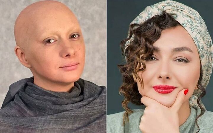 با بازیگران بیمار ایرانی آشنا شوید با بازیگران بیمار ایرانی آشنا شوید