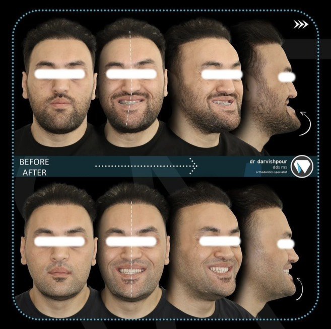 معرفی 13 متخصص ارتودنسی در تهران