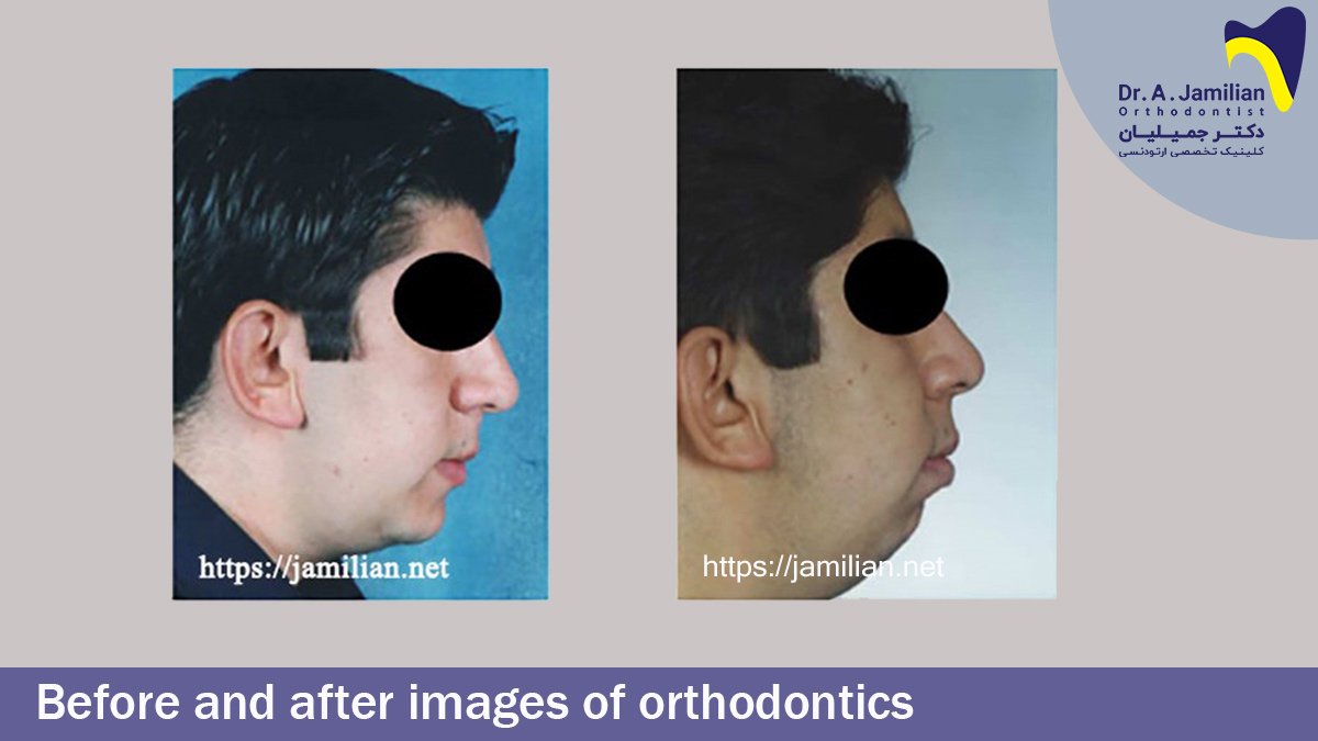 معرفی 13 متخصص ارتودنسی در تهران