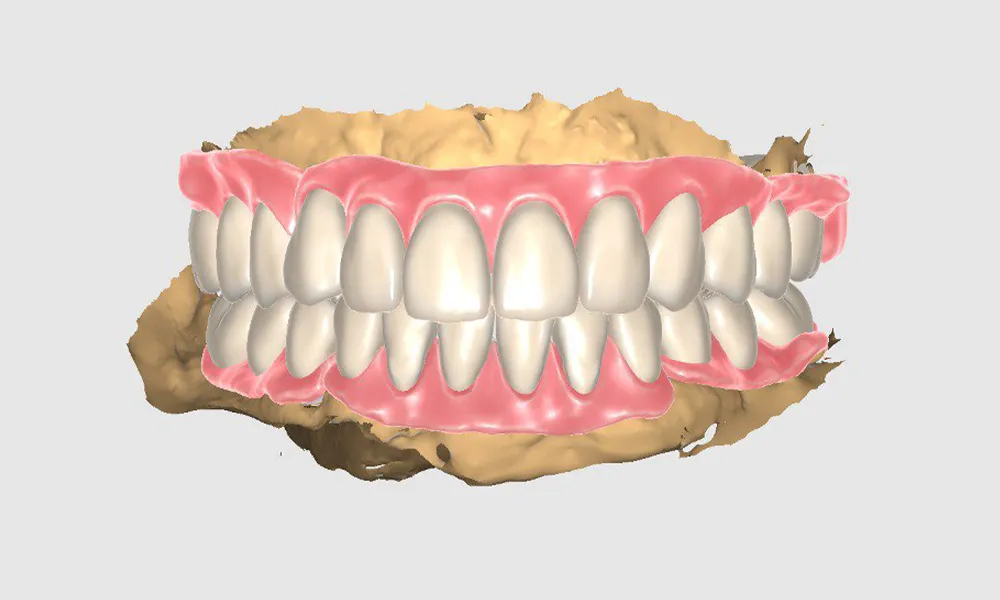 اورال اسکنر چیست؟