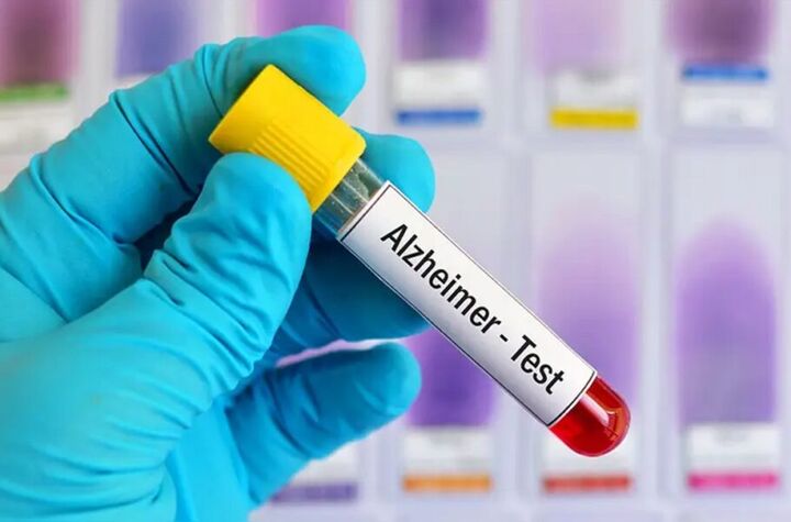 آزمایش خون جدیدی که آلزایمر را با دقت ۹۰ درصد تشخیص میدهد آزمایش خون جدیدی که آلزایمر را با دقت ۹۰ درصد تشخیص میدهد