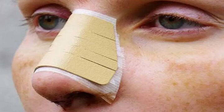 بهترین جراح بینی از نظر کاربران سایت نوبت دهی بهترین جراح بینی از نظر کاربران سایت نوبت دهی