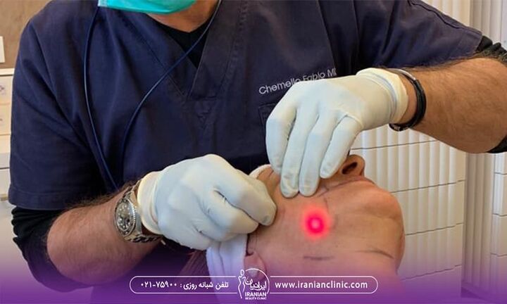 نواحی اندولیفت صورت برای جوانسازی و لیفتینگ چیست؟ نواحی اندولیفت صورت برای جوانسازی و لیفتینگ چیست؟