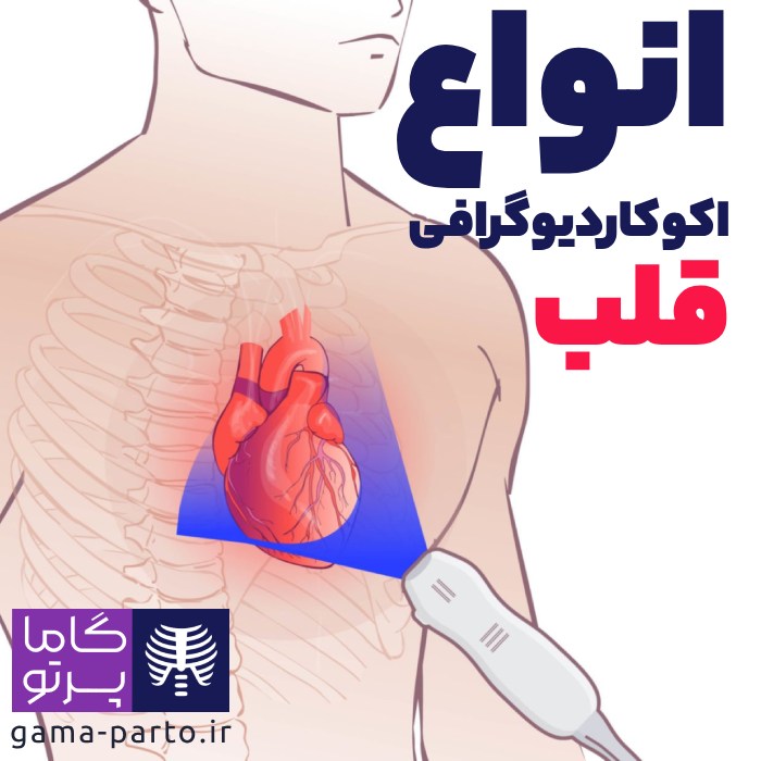 انواع اکوکاردیوگرافی قلب - گاما پرتو