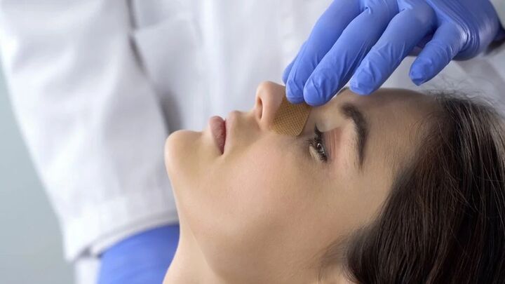 ترمیم بینی عمل شده بدون جراحی در شیراز ترمیم بینی عمل شده بدون جراحی در شیراز