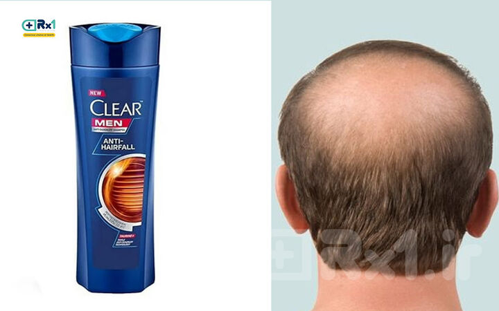 شامپو کلیر ضد ریزش خوبه؟ بررسی ترکیبات و نظرات کاربران شامپو کلیر ضد ریزش خوبه؟ بررسی ترکیبات و نظرات کاربران