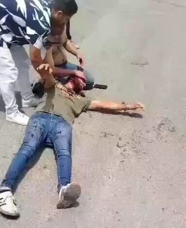 زخمی شدن مردم در اطراف محل انفجار