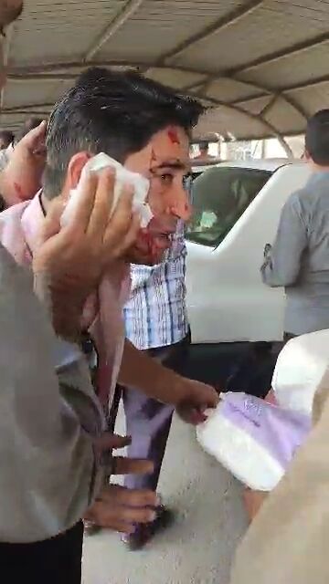 تعداد زیادی از مصدومان امروز بندر شهید رجایی قربانی ترکش شیشهها شدند تعداد زیادی از مصدومان امروز بندر شهید رجایی قربانی ترکش شیشهها شدند