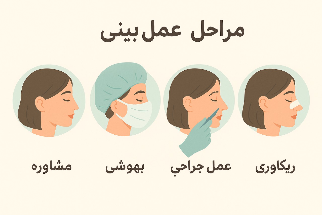 هزینه عمل بینی در بیمارستان دولتی اصفهان