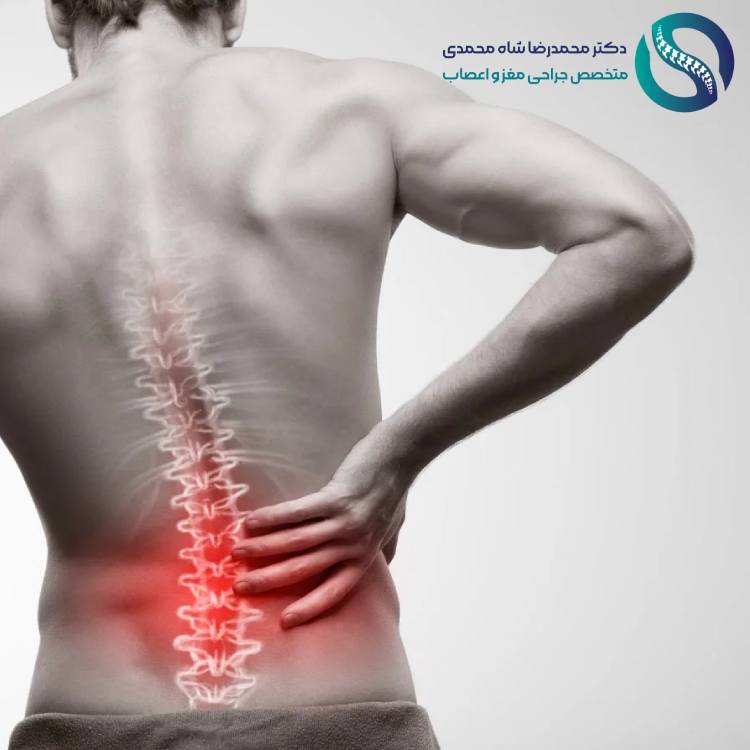چه زمانی برای دیسک کمر باید به پزشک مراجعه کنیم؟