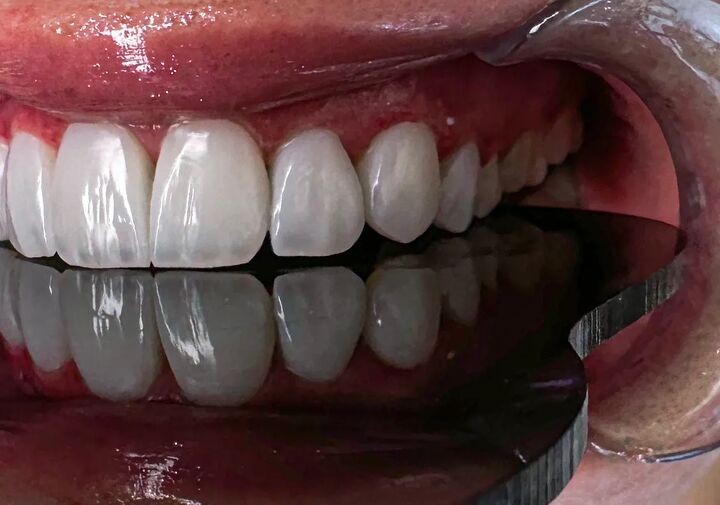 افزایش تقاضا برای خدمات زیبایی دندان در تهران؛ فرصت یا تهدید؟ افزایش تقاضا برای خدمات زیبایی دندان در تهران؛ فرصت یا تهدید؟