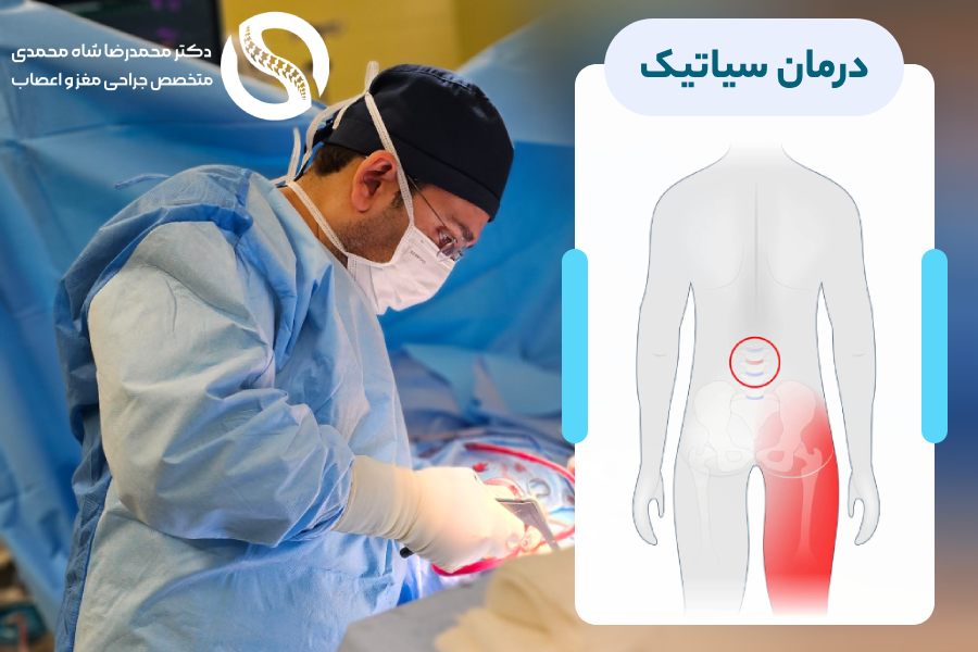 بهترین درمان سیاتیک از نظر دکتر شاه محمدی