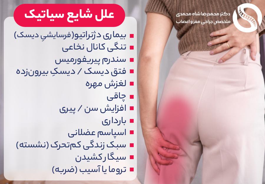 علل شایع سیاتیک - دکتر شاه محمدی متخصص دیسک کمر در تهران