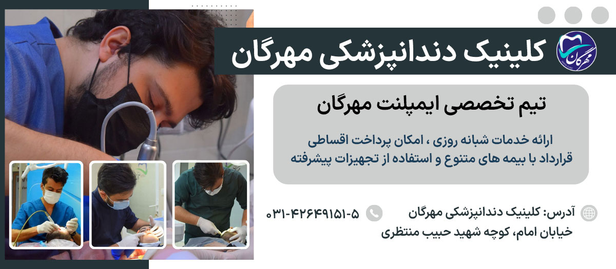 لیست ۱۰ نفر از بهترین متخصصان ایمپلنت در نجف آباد