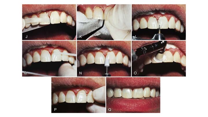 ارتودنسی ارزان در کرج