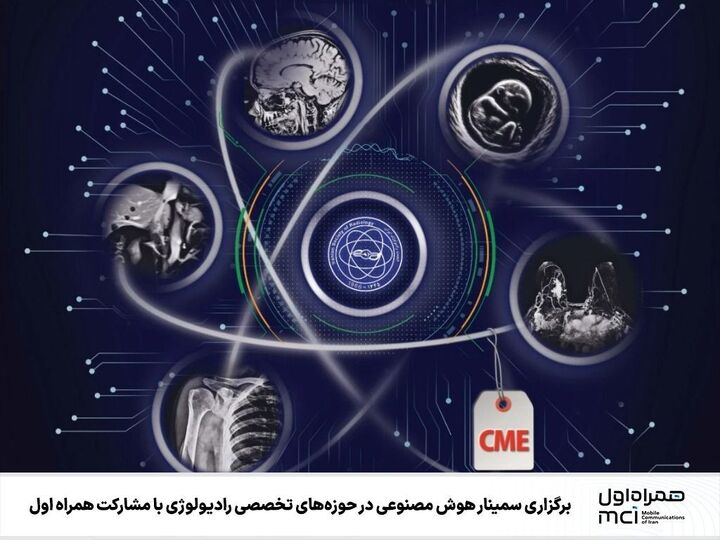 برگزاری سمینار هوش مصنوعی در حوزه‌های تخصصی رادیولوژی با مشارکت همراه اول