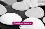 جراحی پروتز سینه و هزینه آن در سال 1405