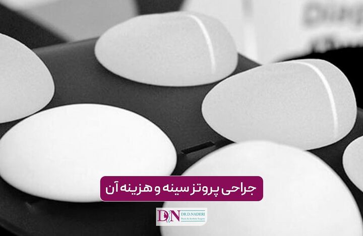 جراحی پروتز سینه و هزینه آن در سال 1405