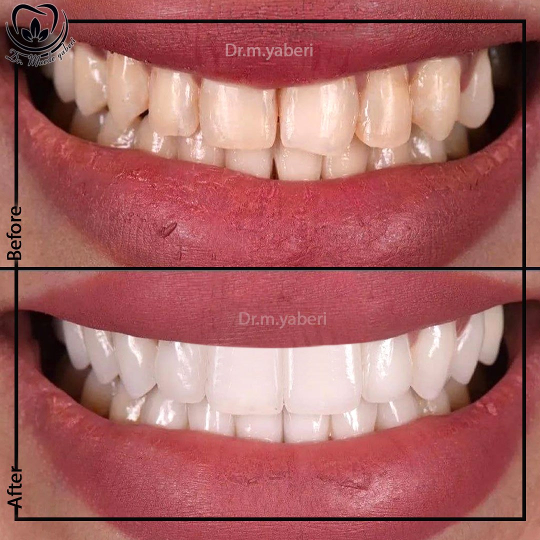 دندانپزشکی‌های طرف قرارداد با بیمه آسیا در شرق و غرب تهران؛ تضمین استانداردهای نوین درمانی
