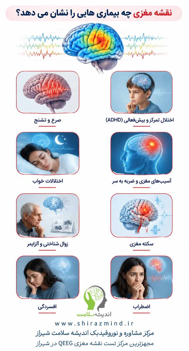 نقشه مغزی چه بیماری هایی را نشان می دهد؟