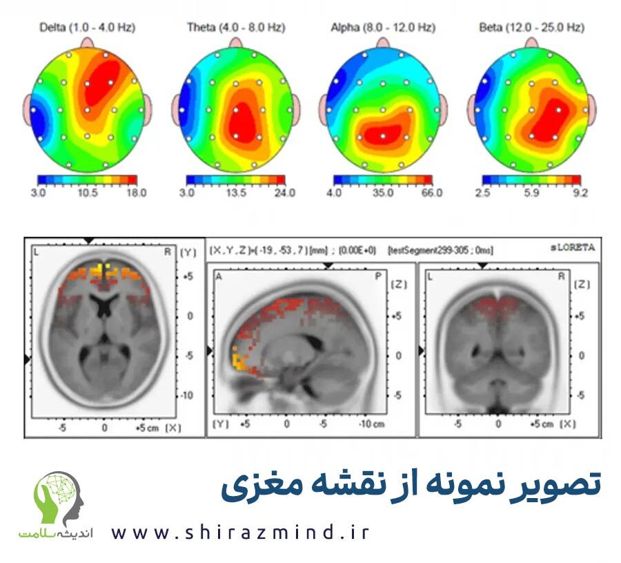 نقشه مغزی چیست و چگونه اطلاعات مغز را ثبت میکند؟