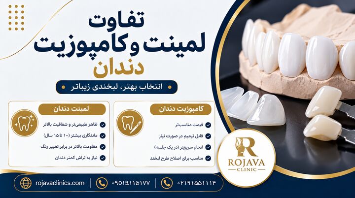 بررسی جامع ۷ تفاوت اصلی لمینت و کامپوزیت دندان به همراه مزایا و معایب