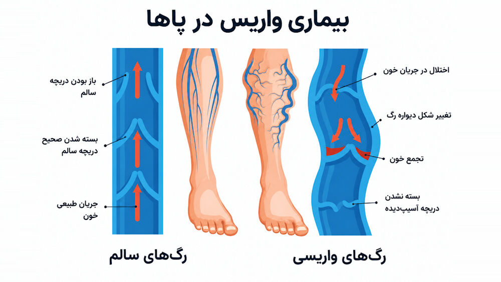 کلینیک تخصصی درمان واریس